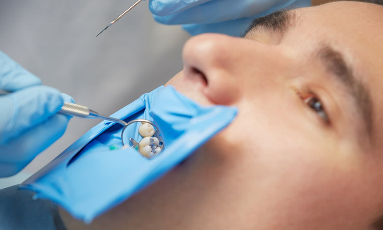 کانال ریشه دندان